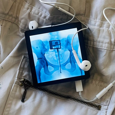 device